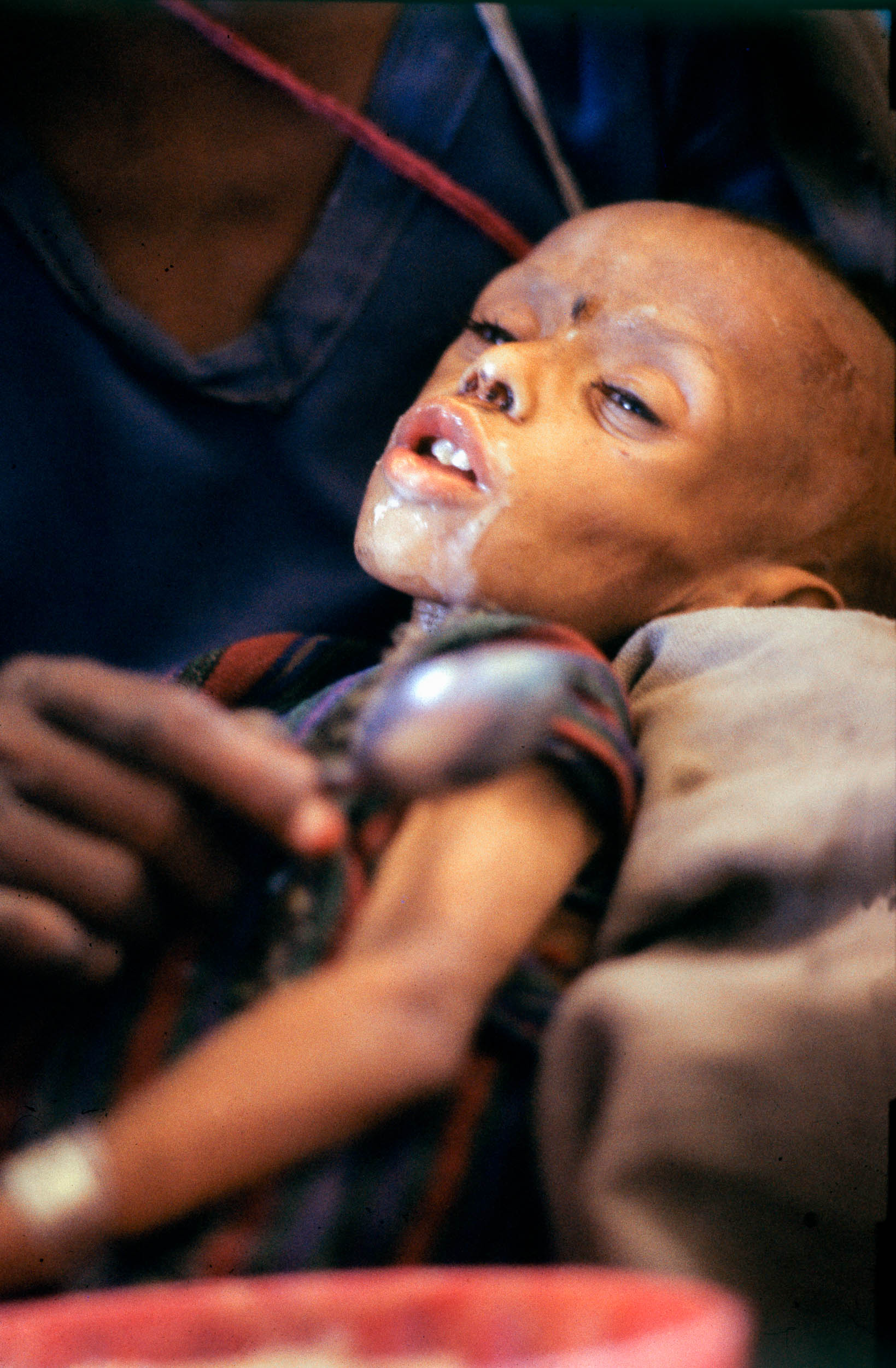 Face of Famine, Ethiopia