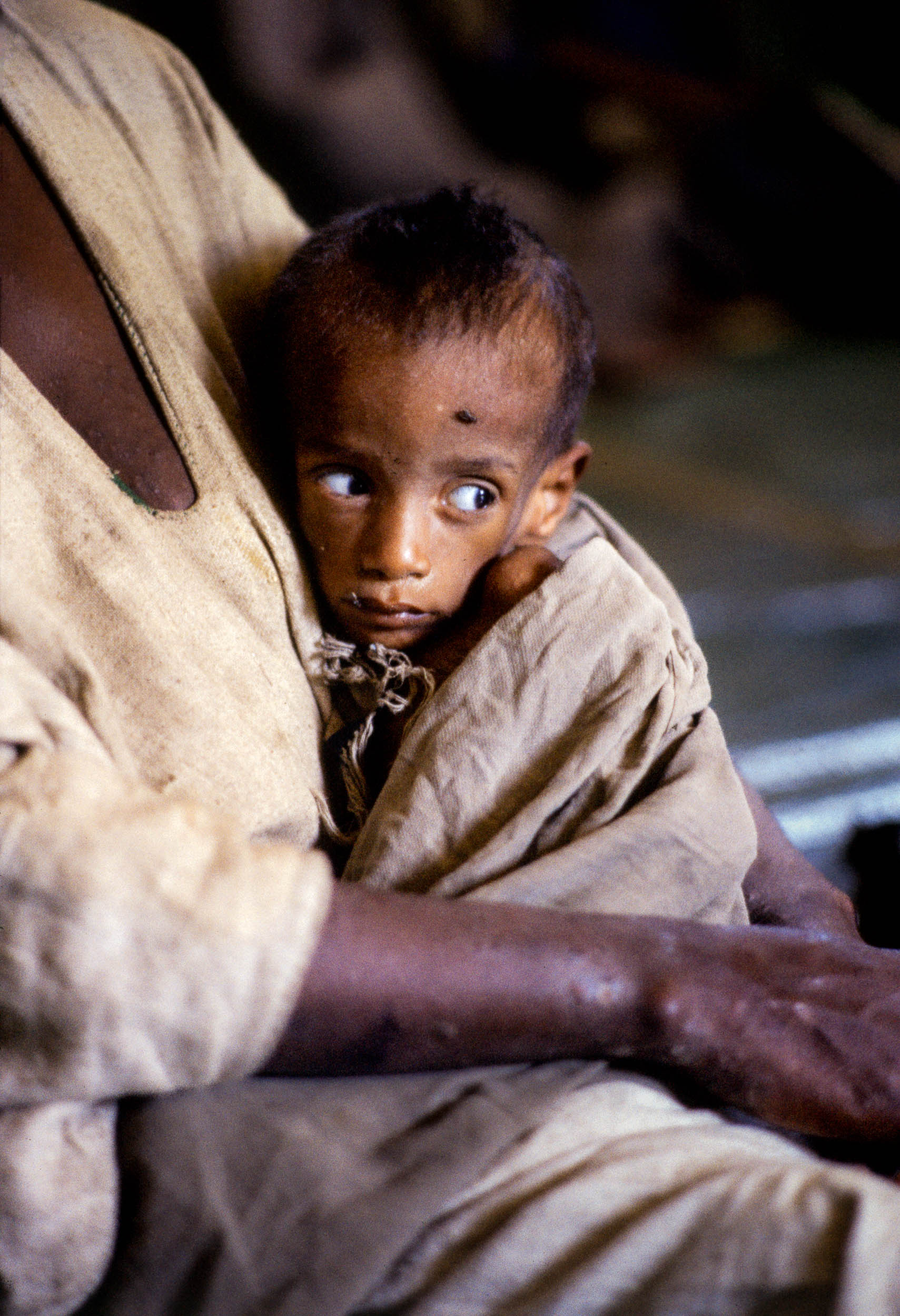 Face of Famine, Ethiopia