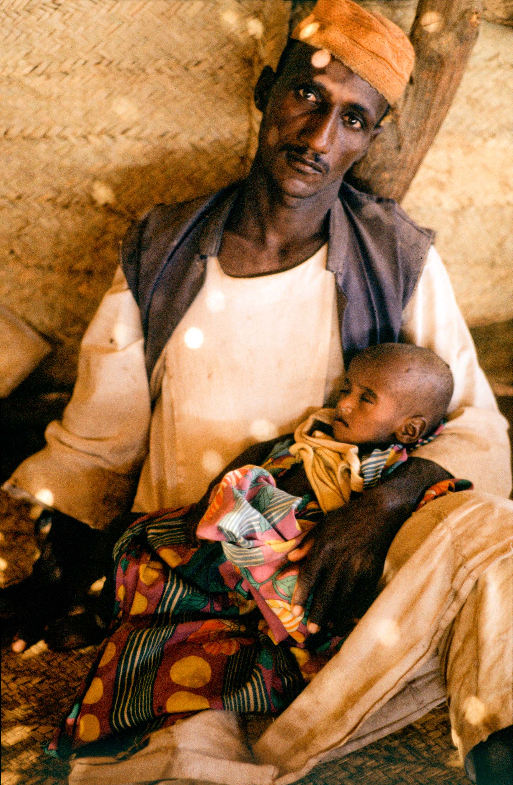 Face of Famine, Ethiopia